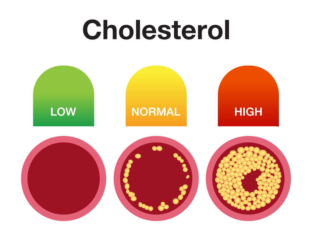 Fy for den kolesterol – Sundhed